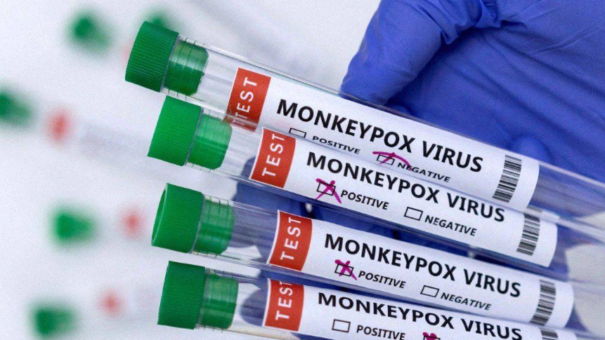 US Declares Emergency Due to Monkeypox